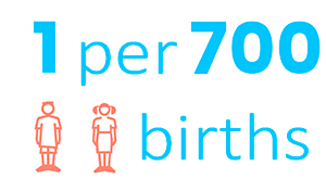 TCAP21-down-syndrome-statistics